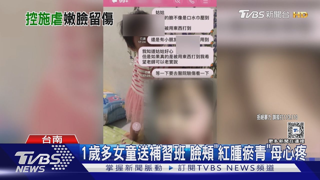 1歲多女童送補習班 臉頰「紅腫瘀青」母心疼｜TVBS新聞 @TVBSNEWS01