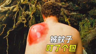 男人背上有個大包，竟然是被蚊子咬得，科幻，奇幻，電影，解說，獵奇，懸疑，冒險，超能力