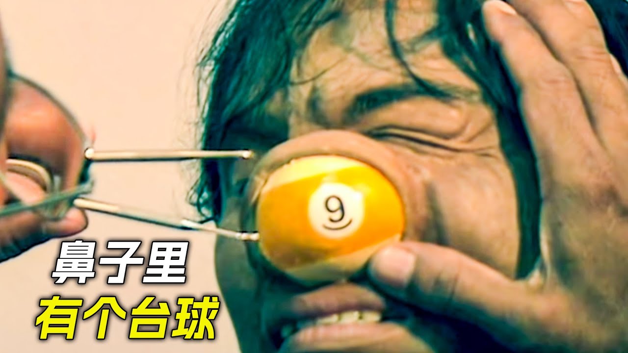 男人鼻子裡有個檯球，醫生怎麼都弄不出來，科幻，奇幻，電影，解說，獵奇，懸疑，喜劇，搞笑，超能力，短片，short films