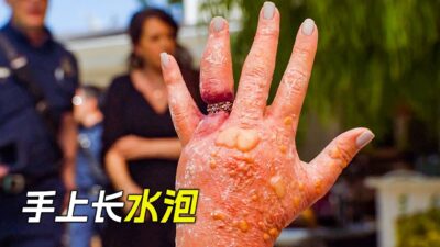 女人對戒指過敏，戴上後手上長出了水泡，科幻，奇幻，電影，解說，獵奇，冒險，救援，短片，short film