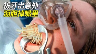 男孩拔牙時意外頻發，海膽掉進了嘴裡，科幻，奇幻，電影，解說，獵奇，超能力，懸疑，冒險，超能力