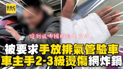 男被要求手放排氣管20秒驗車？車主手2-3級燙傷網炸鍋