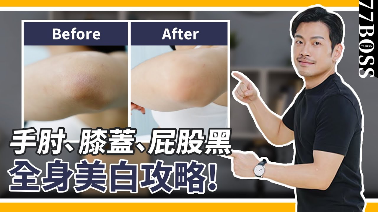 手肘膝蓋髒兮兮、屁股黑沒救了？！超級美白攻略，２８天白到你發亮～～！【77老大】