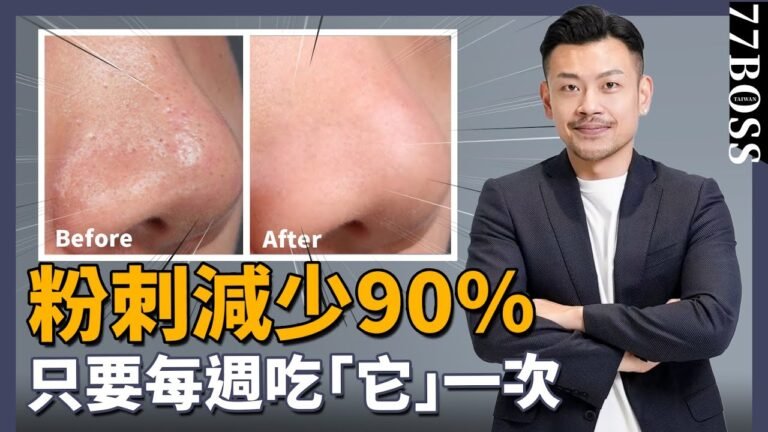 粉刺清不掉?痘痘一直長?吃『它』超有效,大幅降低粉刺發生率!【77老大】 hq720